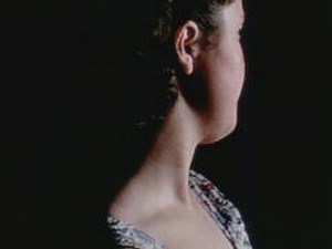 Jugular venous pulse (1957) Pt. 2 of 4