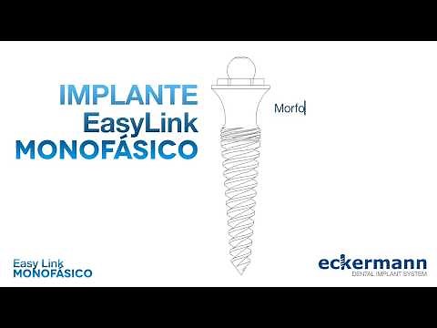 Implante Monofásico Easy Link de Eckermann - Un primer vistazo