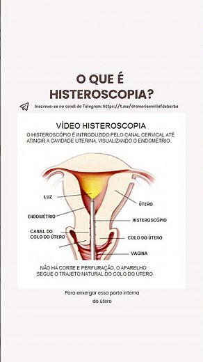 O que é Histeroscopia?