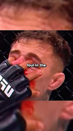 Ashx on Instagram: "Is Ciryl Gane A Dirty Figher? #ufc"