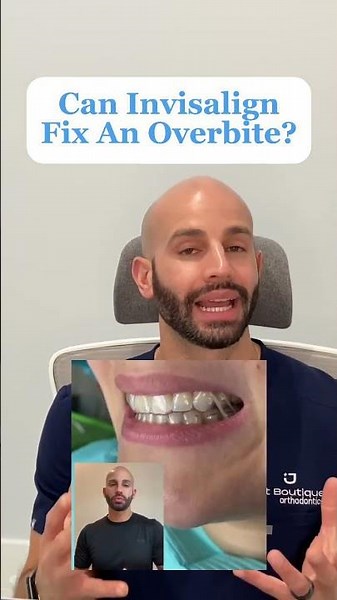 Can Invisalign Fix An Overbite? And What About Jaw Surgery?