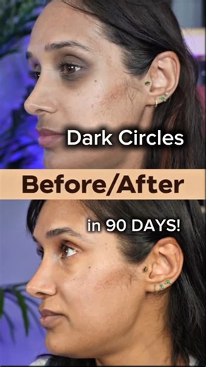 Dr Vanita Rattan - Doctor & Cosmetic Formulator on Instagram: "Dark circles + hyperpigmentation routine for skin of colour. AM Micellar gel wash Cera pep brightening moisturiser Inzincable spf50 PM Oil melting cleanser Micellar Gel Wash Dark circles kit Facial hyperpigmentation kit Anti oxidant power serum (retinol + Retinal) Cera pep brightening moisturiser Available now- ship to 90 countries www.skincarebydrv.com Love Dr V x #Skincare #darkcircles #hyperpigmentation"