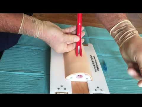 Cric Guide insertion
