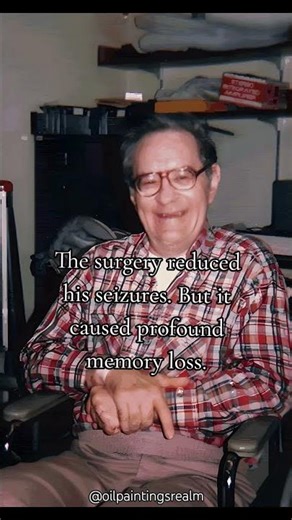 A Surgery Removed His Memory. He Gave Science 55 Years Anyway. #history #hiddenhistory #science