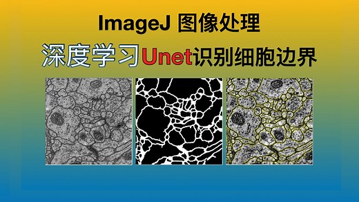 『超实用』ImageJ图像处理 - 深度学习Unet区分处理识别细胞膜 DeepImageJ使用指南