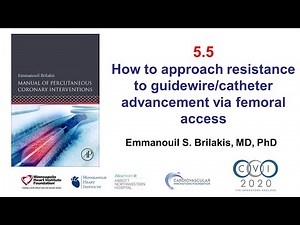 5.5 Manual of PCI - Resistance to guidewire/catheter advancement via femoral access