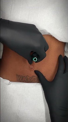 Check this out! 💎 Belly dermal piercing