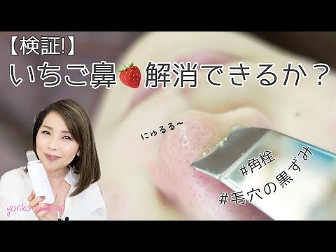【お悩み解決】検証‼️いちご鼻 毛穴の黒ずみ 角栓をキレイに取り去れるか⁉️ウォーターピーリング☆YORIKO makeup