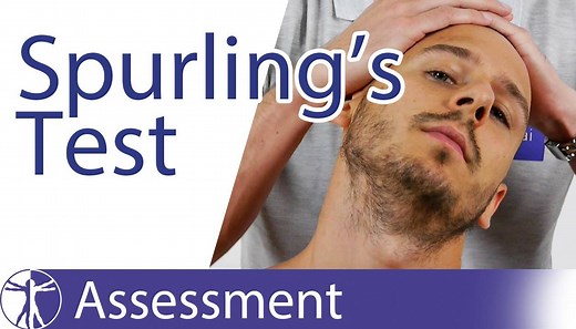 CERVICAL RADICULAR SYNDROME: THE SPURLING'S TEST So no red flags detected in the cervical area? Good, then it's time to make sense to figure out if our patient with neurological sign & symptoms in the arm and/or fingers is suffering from Cervical Radicular Syndrome. The Spurling's Test has been found to be the most specific clinical test in the diagnosis of cervical radiculopathy (CR) with values indicating a low-high sensitivity (50-100%) and a high specificity (92-100%) according to a systemat