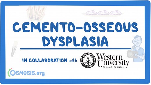 Cemento-osseous dysplasia: Video, Causes, & Meaning | Osmosis