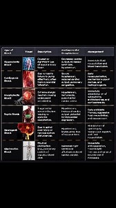 🔍 Understanding Different Types of Circulatory Shock💡 https://www.instagram.com/share/reel/BAF1WjCoot 📊 Check out this comparison chart highlighting various types of Circulatory Shock, including Hypovolemic, Cardiogenic, Anaphylactic, Septic, Neurogenic, and Obstructive. #Cardiology #ShockManagement #MedicalEducation #Cardiologists #Healthcare #MedicalProfessionals #HeartHealth #PatientCare #MedicalKnowledge #CardiovascularComplications #EmergencyMedicine #CriticalCare #MedicalResearch #Medic