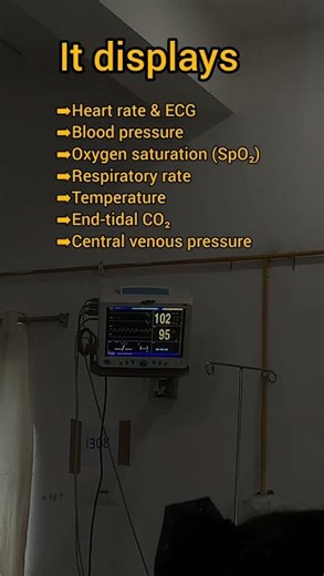 Ever wondered what those ICU monitors really show?