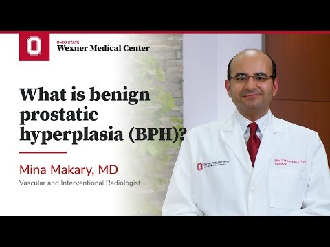 What is benign prostatic hyperplasia (BPH)? | Ohio State Medical Center