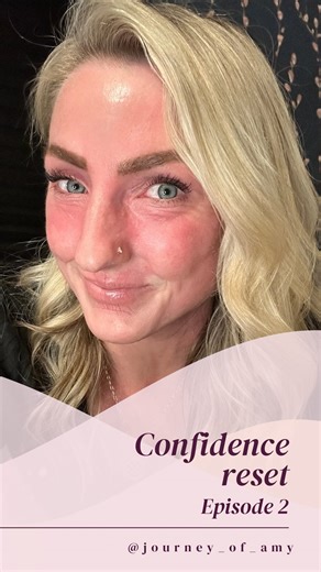 Amy Wilson on Instagram: "Day 2 of The Confidence Reset. Today I’m focusing on gratitude and not in a “be positive” way, but in a real, grounding, steadying-myself kind of way. The small things that make my day feel lighter… the moments that remind me I’m stronger than I think. I’m also doing my first methotrexate injection today. I’ve taken it as tablets before, and I’ve been on Dupixent injections… but starting something new still brings up nerves. So before I take it, I’m slowing down and cho