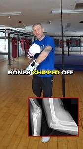 3.6K views · 21 reactions | What is the worst injury you have ever...