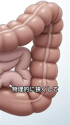 便秘は“放置NG”！運動や食物繊維では治らない“危険な便秘”とは？【医師解説】