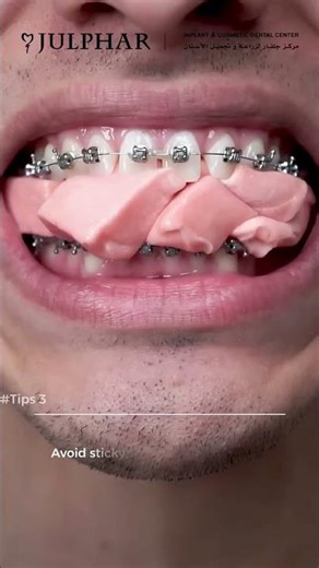 Post-Operative Care After Braces | Orthodontist Tips