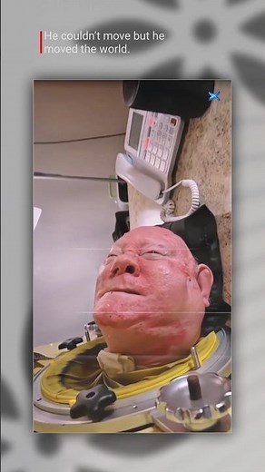 Paul Alexander: The Man Who Lived 70 Years in an Iron Lung | Unbelievable Survival Story