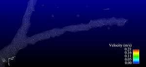 File:Assessment-of-the-kidneys-magnetic-resonance-angiography-perfusion-and-diffusion-1532-429X-13-70-S1.ogv - Wikimedia Commons