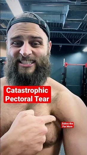 😮8 Months Ago I Had A Catastrophic Pectoral Tear! #Shorts #Fitness #weightlifting #strengthtraining