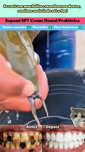 Sua boca merece Sopami SP7 ❤️ #SP7 #HigienePerfeita #CuidadoBucal -js