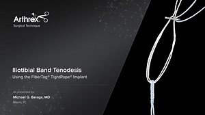 Iliotibial Band Tenodesis Using the FiberTag® TightRope® Implant