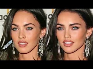 how did your midface get so compressed and shorter?