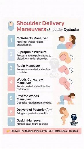 🚨 Shoulder Dystocia – Life-saving Maneuvers every Nurse & Medical Student must know! From McRoberts to Gaskin, these steps can make a huge difference in obstetric emergencies. 🍼 Perfect for AIIMS NORCET, NCLEX NEET PG & Nursing Exams revision! 👉 Save & Share with your study group #ShoulderDystocia #ObstetricEmergency #NursingNotes #NorcetPreparation #NursingExam #MedicalStudents #ObstetricsAndGynecology #NursingStudy #NursingMindset #TheNursingMind #NurseLife #GlobalNursing #InternationalNurs