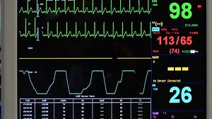 Vital Signs Monitor Stock Footage Video (100% Royalty-free) 15047944 | Shutterstock