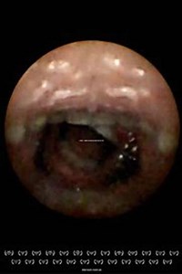 Feeder (2010) - Movie