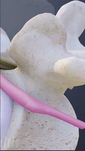 Understanding L5-S1 Problems & Lumbar Nerve Root Pain