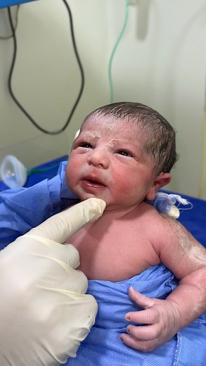 359K views · 10K reactions | #baby moro reflex | اسلام الدح | Facebook