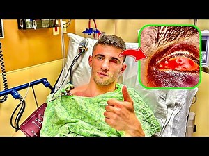 i have a serious eyeball injury..