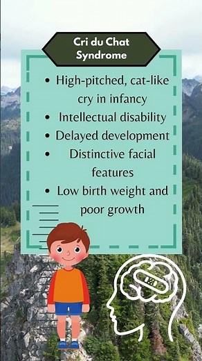 Cri du Chat Syndrome #criduchatsyndrome #syndrome #symptoms #medicine