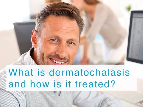 What is dermatochalasis and how is it treated?