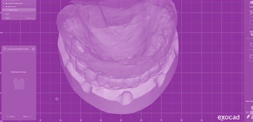Full Arch Workflow Panthera exocad
