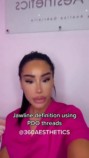 Jawline Definition Using PDO Threads