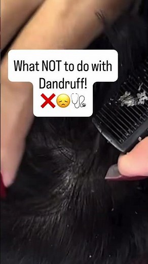 Stop scratching off your dandruff. Your scalp will thank you!