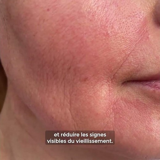 Tripeptides in Skincare: Boost Collagen & Elasticity