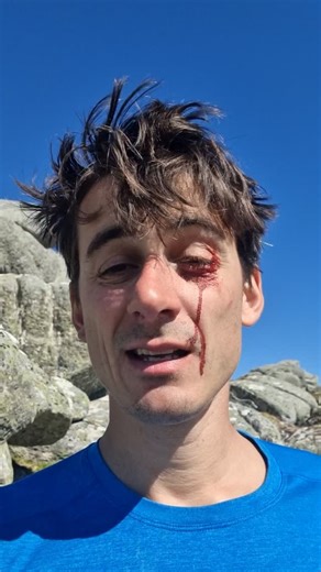 Franco Cookson | Climber 🏴󠁧󠁢󠁷󠁬󠁳󠁿 on Instagram: "Omg, we're nearly in Ben Loyal season! This was last year. It was actually quite a scary moment, as I obviously had no mirror or person with me to check my eye, but just had blood pouring out of it. There was also a huge water shortage on the hill, so had to jug up the fixed lines and strip all the ropes before walking 5 miles out to clean it. We're now entering Y4... check out my story highlights for the trip so far 🤪 One of the great thin
