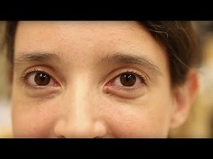 Creating Retinas in a Dish: Transforming the Study and Treatment of Retinal Diseases