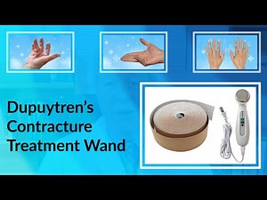 Early Stage Dupuytren's Contracture Home Treatment to Avoid or Delay Surgery