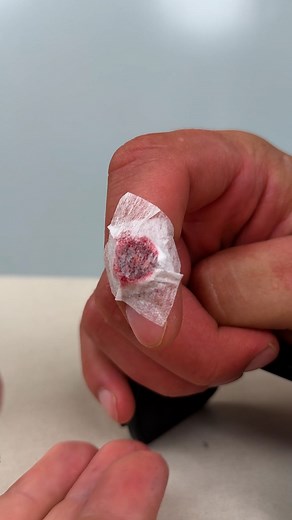983K views · 259 reactions | Smart Way to Patch a Finger Bump | Genius Inventions | Facebook