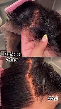 Undetectable wigs are easy with this expert wig knot lightening tutorial #BW2plus #wigs #ClairolPro