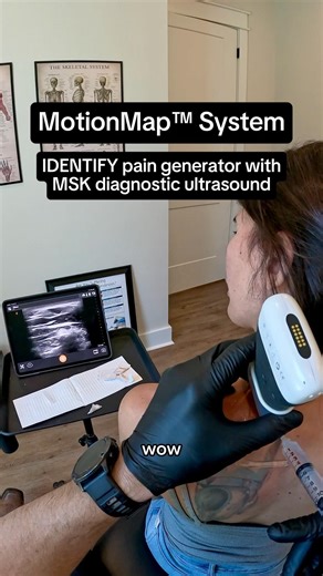 MotionMap™ System to solve chronic neck pain for 20+ years