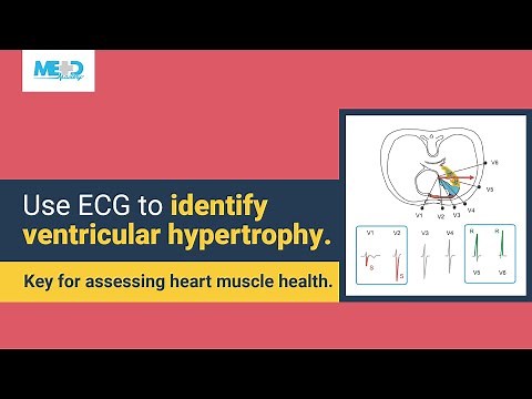How to recognize ventricular hypertrophy