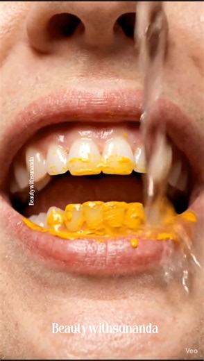 whiten teeth Naturally at home #shorts #youtubeshorts #viralshorts #teethwhitening