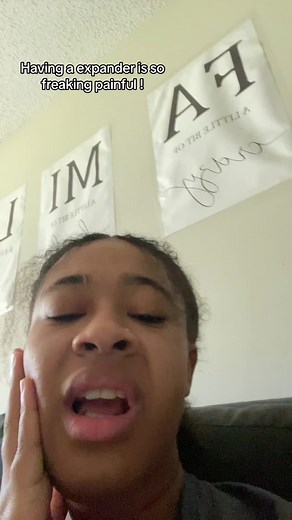 Old draft… but anywaysssThen you have to turn it every night the pressure is CRAZY 😔 #expander #palateexpander #braceson #braces#bracestips #bracesguide #viral #fyp #fypシ