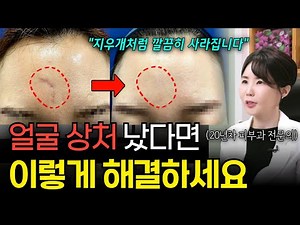 얼굴 흉터 생겼을때, '이렇게' 치료해야 얼굴흉터 안 남습니다! [흉터치료, 흉터없애는법]