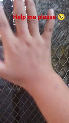 help me please call 911